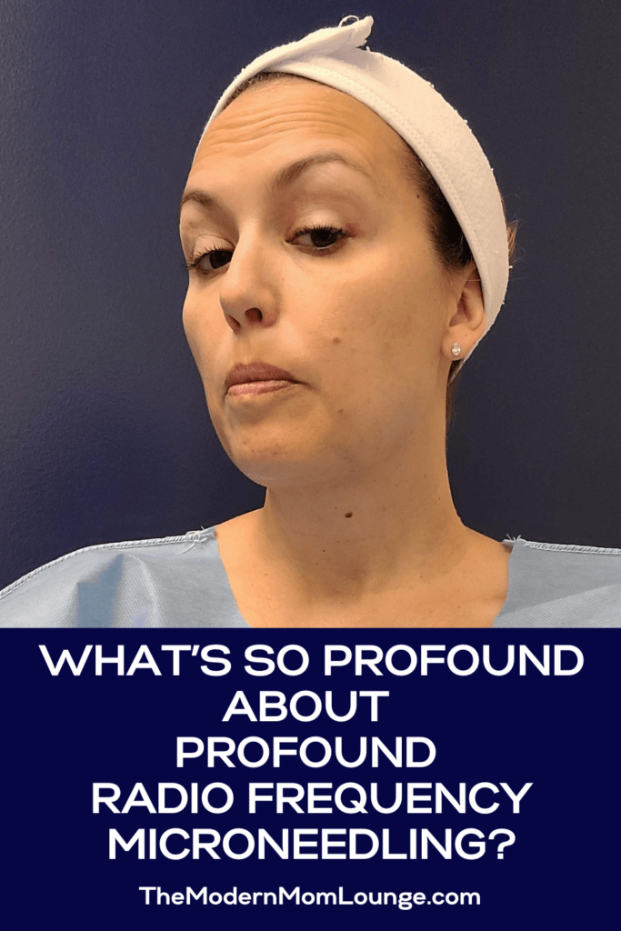 What’s So Profound About Profound Radio Frequency Microneedling?
